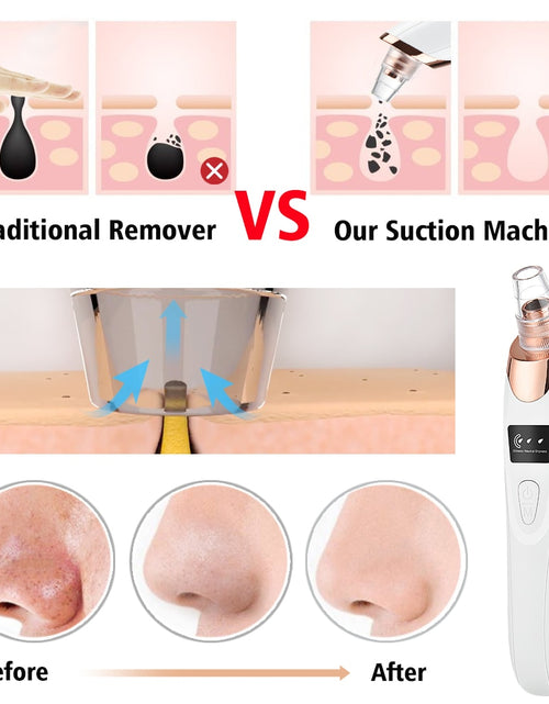 Load image into Gallery viewer, Beauty Electric Blackhead Remover
